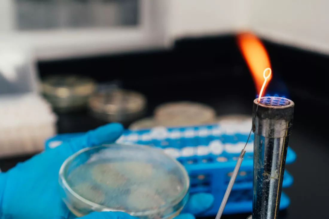 Des mains gantees tiennent une boite de Petri pres de la flamme d un bruleur dans un laboratoire de chimie.